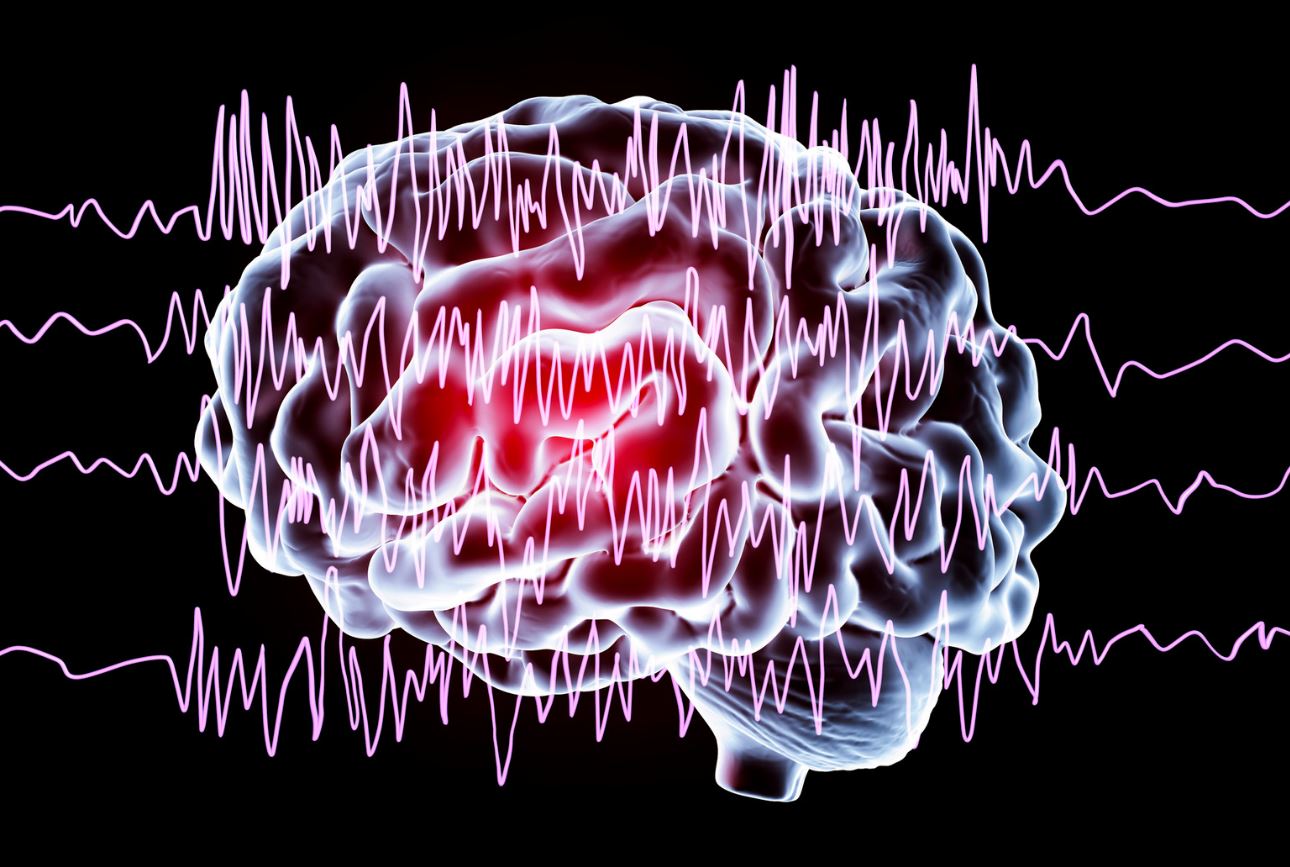 Neurolog z Dąbrowy Górniczej: w jakich sytuacjach pomaga?